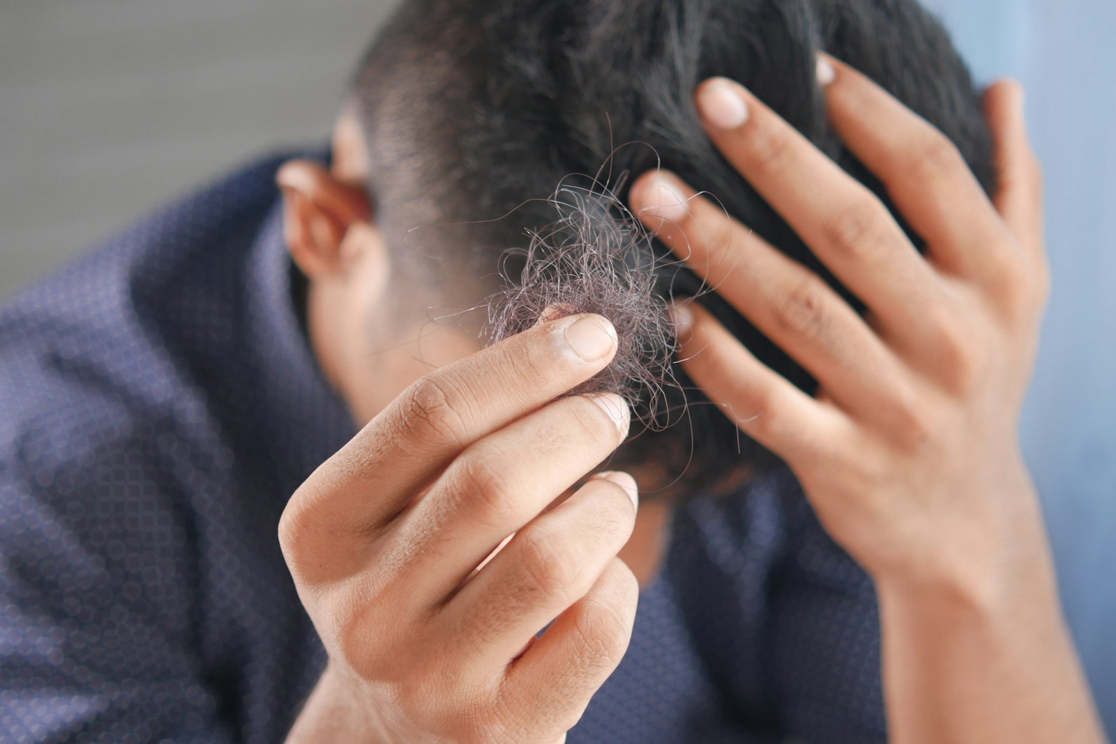 ಕೂದಲು ಉದುರುವಿಕೆ (Hair Loss) - RJR Herbal Hospitals Treatment ಕೂದಲು ಉದುರುವಿಕೆ (Hair Loss) - ಗಿಡಮೂಲಿಕೆ ಚಿಕಿತ್ಸೆ